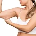 Arm liposuctie